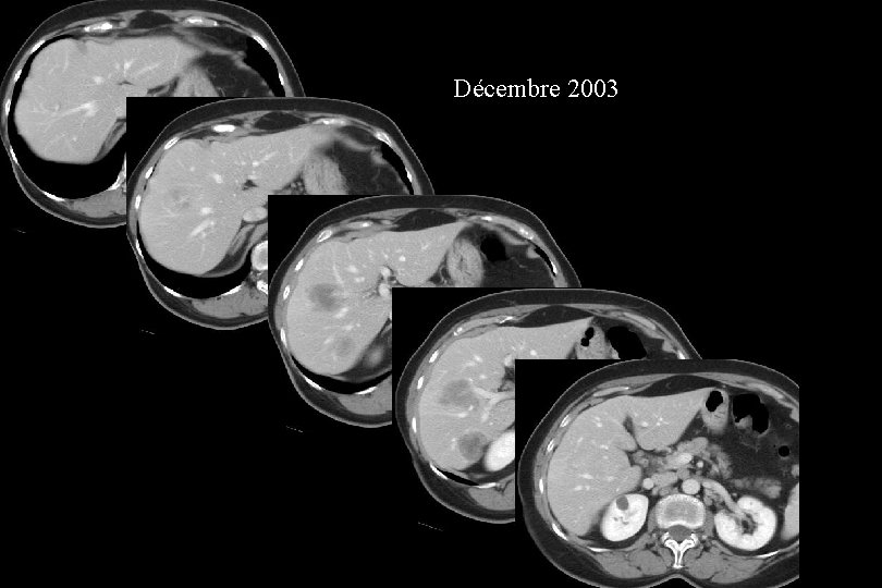Décembre 2003 
