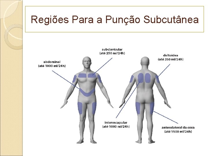 Regiões Para a Punção Subcutânea 