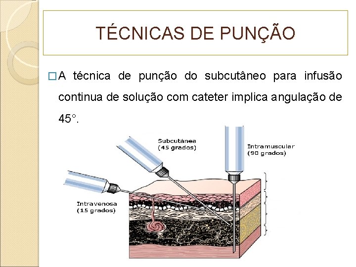 TÉCNICAS DE PUNÇÃO �A técnica de punção do subcutâneo para infusão continua de solução