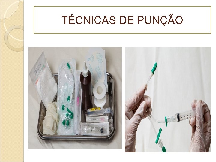 TÉCNICAS DE PUNÇÃO 