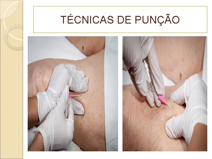 TÉCNICAS DE PUNÇÃO 