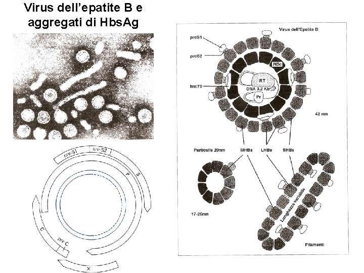 Virus dell’epatite B e aggregati di Hbs. Ag 