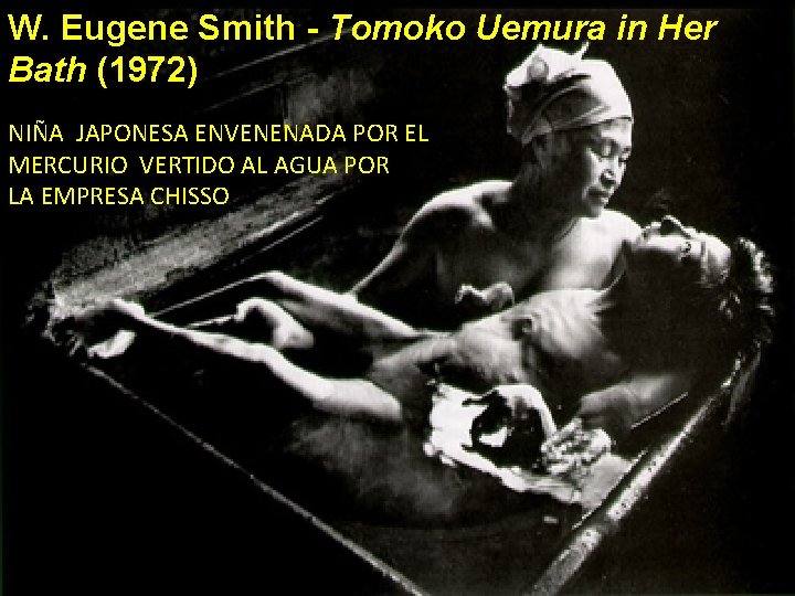 W. Eugene Smith - Tomoko Uemura in Her Bath (1972) NIÑA JAPONESA ENVENENADA POR