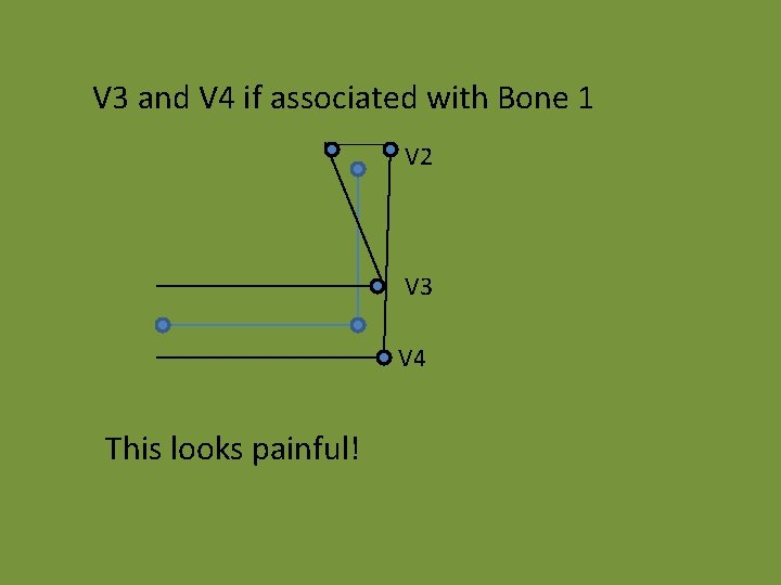 V 3 and V 4 if associated with Bone 1 V 2 V 3