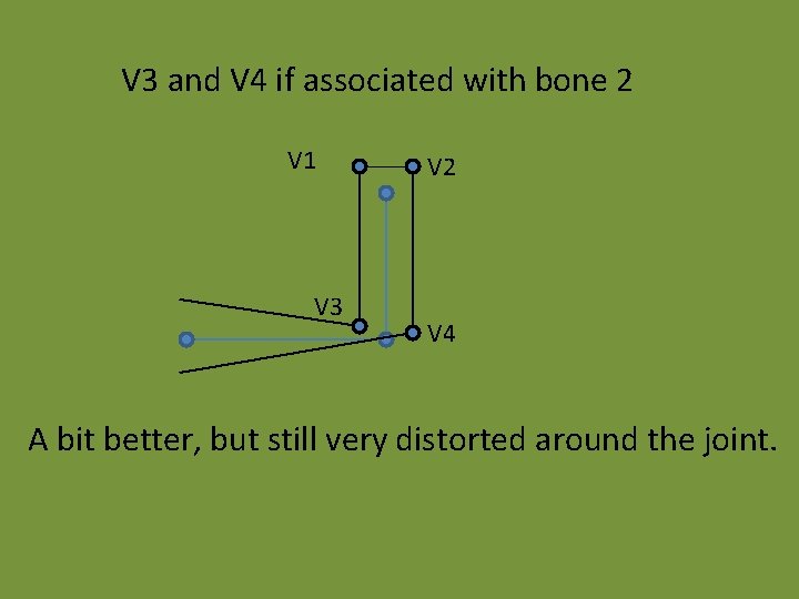 V 3 and V 4 if associated with bone 2 V 1 V 3