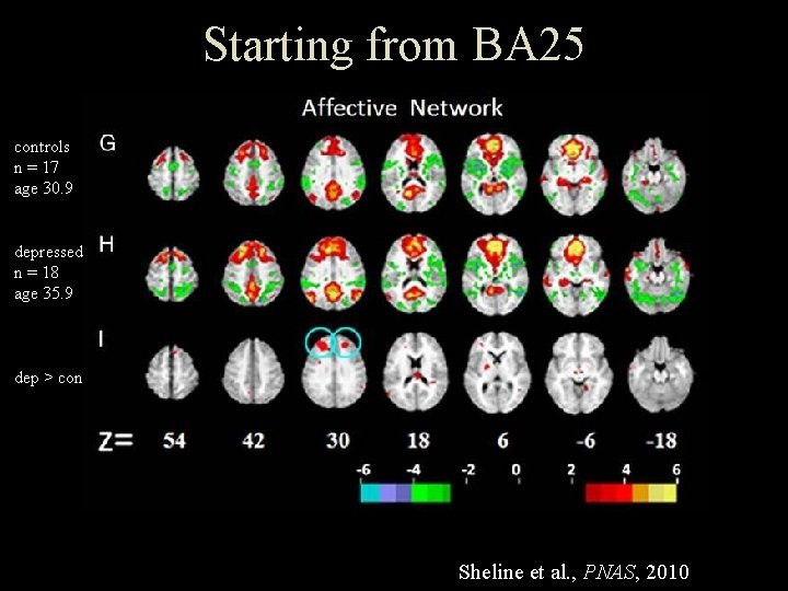Starting from BA 25 controls n = 17 age 30. 9 depressed n =