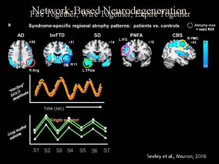 Network-Based Neurodegeneration Fire Together, Wire Together, Expire Together ” ng i t es “R
