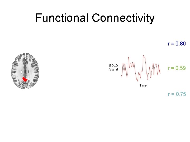 Functional Connectivity r = 0. 80 BOLD Signal r = 0. 59 Time r