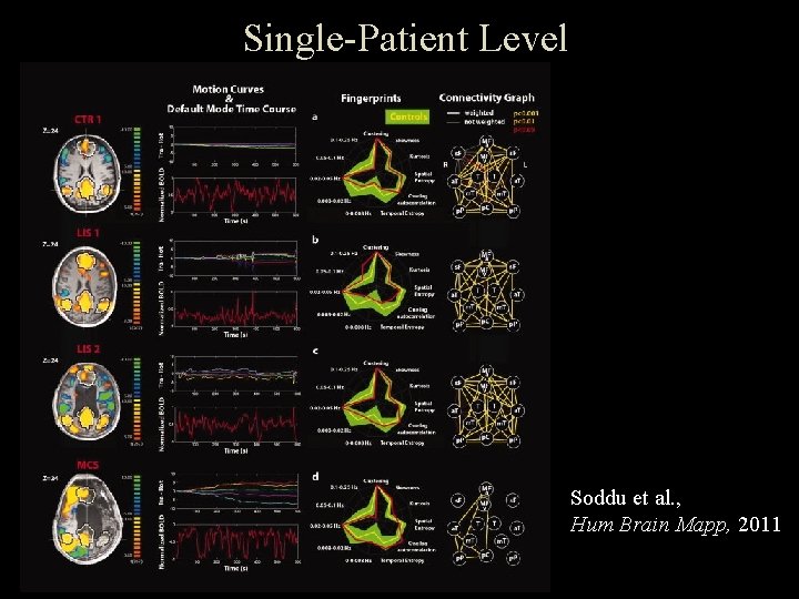 Single-Patient Level Soddu et al. , Hum Brain Mapp, 2011 