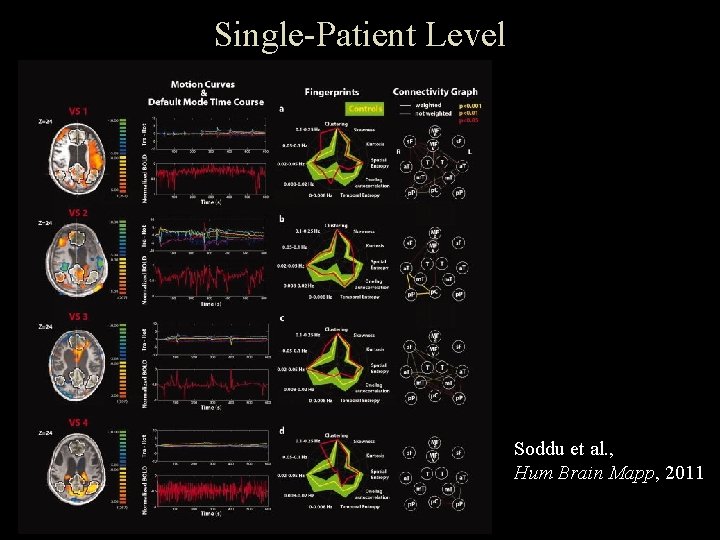 Single-Patient Level Soddu et al. , Hum Brain Mapp, 2011 