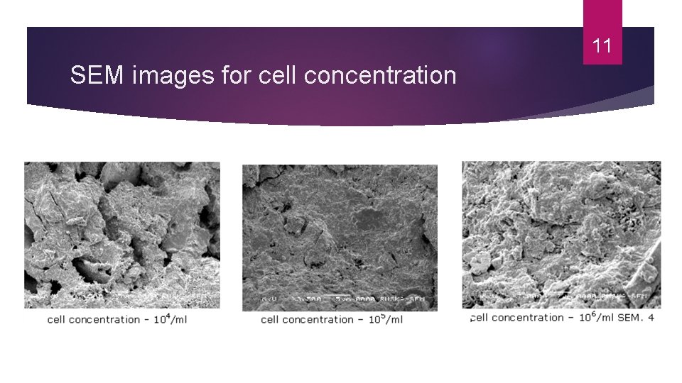 11 SEM images for cell concentration 