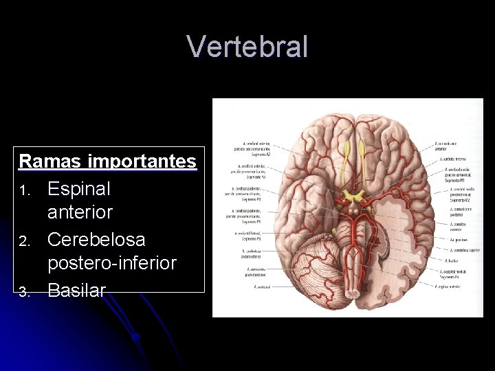 Vertebral Ramas importantes 1. Espinal anterior 2. Cerebelosa postero-inferior 3. Basilar 