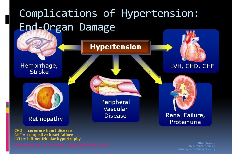 Complications of Hypertension: End-Organ Damage Hypertension Hemorrhage, Stroke Retinopathy LVH, CHD, CHF Peripheral Vascular