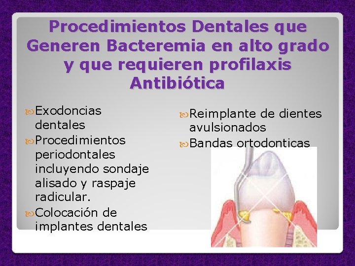 Procedimientos Dentales que Generen Bacteremia en alto grado y que requieren profilaxis Antibiótica Exodoncias