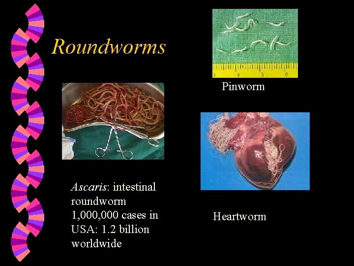 Roundworms Pinworm Ascaris: intestinal roundworm 1, 000 cases in USA: 1. 2 billion worldwide