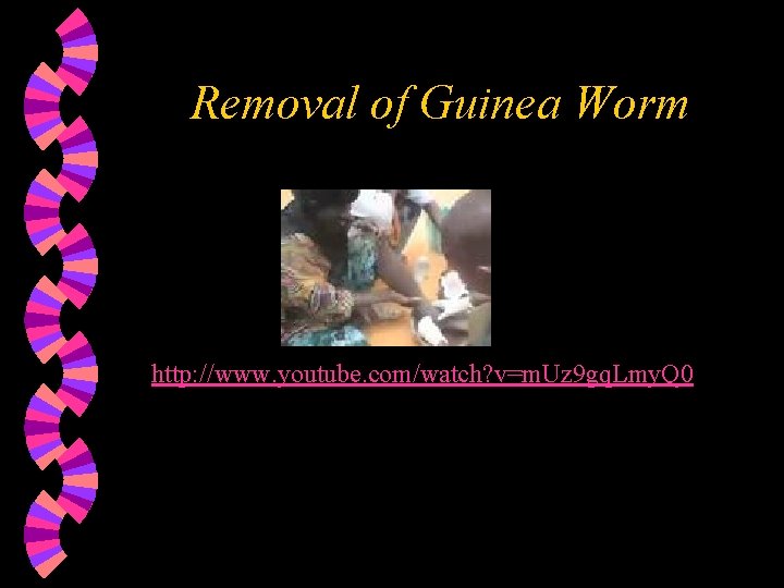 Removal of Guinea Worm http: //www. youtube. com/watch? v=m. Uz 9 gq. Lmy. Q