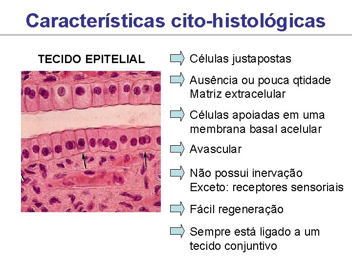 Características cito-histológicas TECIDO EPITELIAL Células justapostas Ausência ou pouca qtidade Matriz extracelular Células apoiadas Características cito-histológicas TECIDO EPITELIAL Células justapostas Ausência ou pouca qtidade Matriz extracelular Células apoiadas