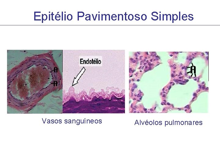 Epitélio Pavimentoso Simples Vasos sanguíneos Alvéolos pulmonares Epitélio Pavimentoso Simples Vasos sanguíneos Alvéolos pulmonares