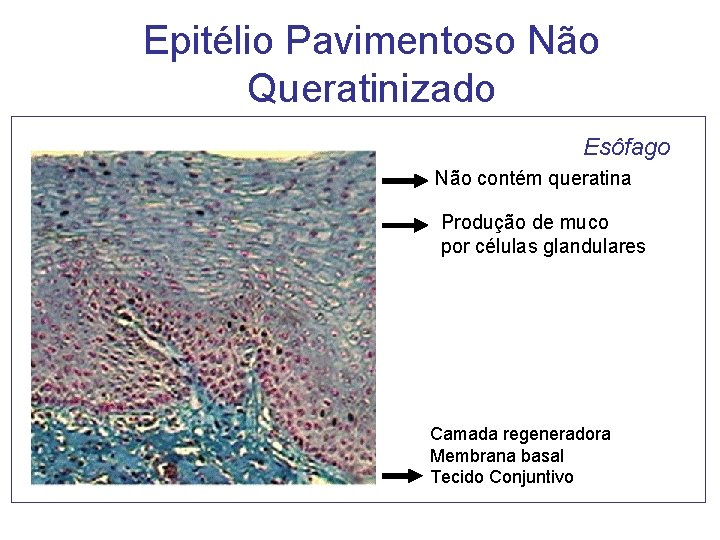 Epitélio Pavimentoso Não Queratinizado Esôfago Não contém queratina Produção de muco por células glandulares Epitélio Pavimentoso Não Queratinizado Esôfago Não contém queratina Produção de muco por células glandulares