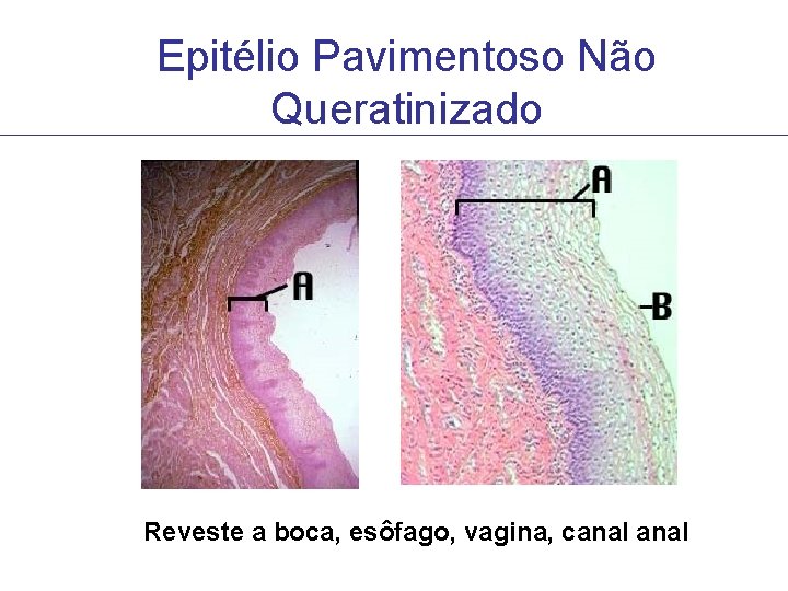 Epitélio Pavimentoso Não Queratinizado Reveste a boca, esôfago, vagina, canal Epitélio Pavimentoso Não Queratinizado Reveste a boca, esôfago, vagina, canal
