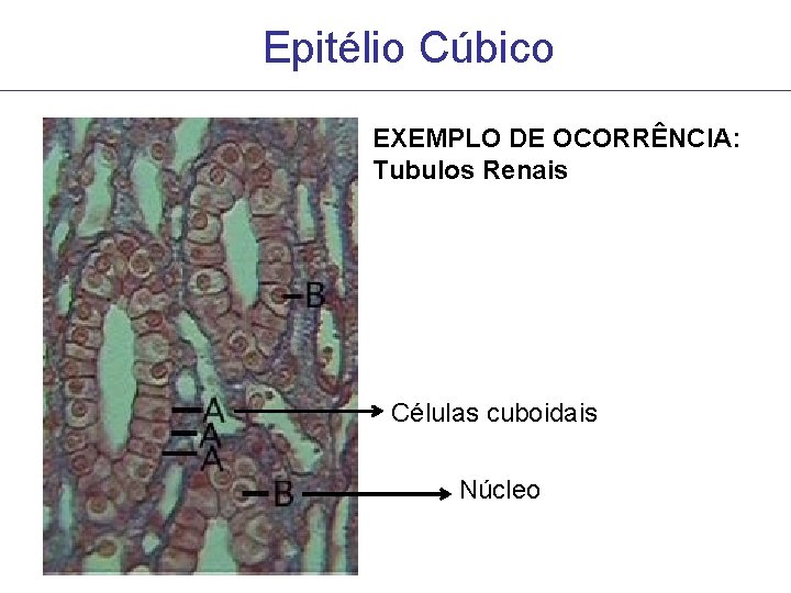 Epitélio Cúbico EXEMPLO DE OCORRÊNCIA: Tubulos Renais Células cuboidais Núcleo Epitélio Cúbico EXEMPLO DE OCORRÊNCIA: Tubulos Renais Células cuboidais Núcleo