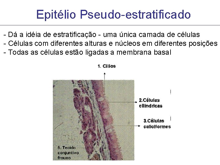 Epitélio Pseudo-estratificado - Dá a idéia de estratificação - uma única camada de células Epitélio Pseudo-estratificado - Dá a idéia de estratificação - uma única camada de células
