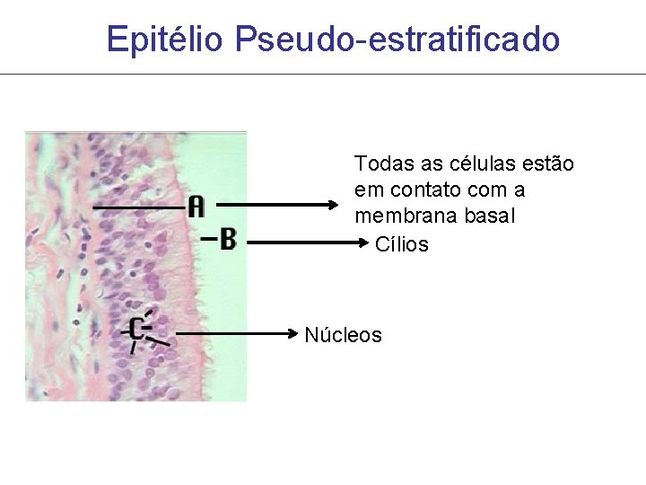 Epitélio Pseudo-estratificado Todas as células estão em contato com a membrana basal Cílios Núcleos Epitélio Pseudo-estratificado Todas as células estão em contato com a membrana basal Cílios Núcleos