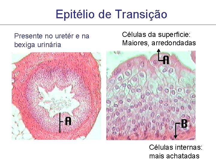 Epitélio de Transição Presente no uretér e na bexiga urinária Células da superficie: Maiores, Epitélio de Transição Presente no uretér e na bexiga urinária Células da superficie: Maiores,