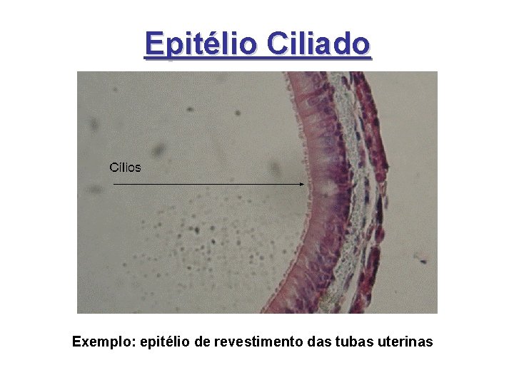 Epitélio Ciliado Exemplo: epitélio de revestimento das tubas uterinas Epitélio Ciliado Exemplo: epitélio de revestimento das tubas uterinas