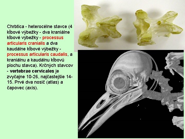 Chrbtica - heterocélne stavce (4 kĺbové výbežky - dva kraniálne kĺbové výbežky - processus