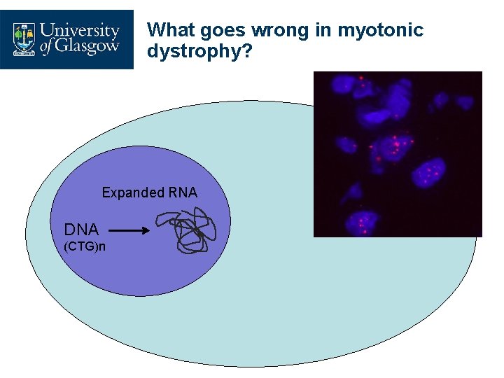 What goes wrong in myotonic dystrophy? Expanded RNA DNA (CTG)n 