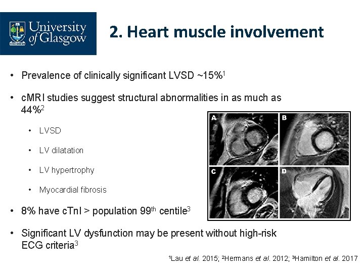2. Heart muscle involvement • Prevalence of clinically significant LVSD ~15%1 • c. MRI