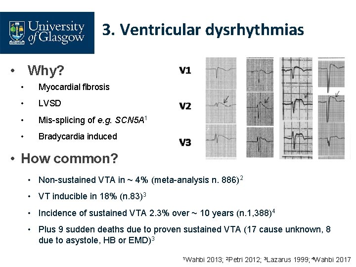 3. Ventricular dysrhythmias • Why? • Myocardial fibrosis • LVSD • Mis-splicing of e.