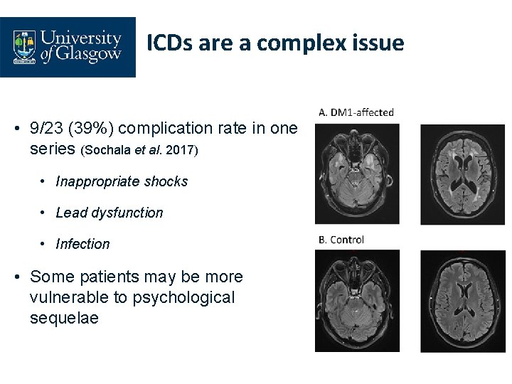 ICDs are a complex issue • 9/23 (39%) complication rate in one series (Sochala