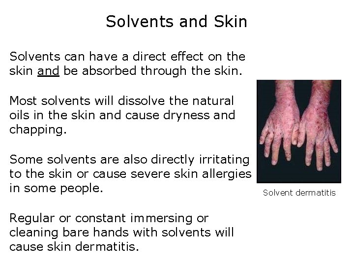 Solvents and Skin Solvents can have a direct effect on the skin and be