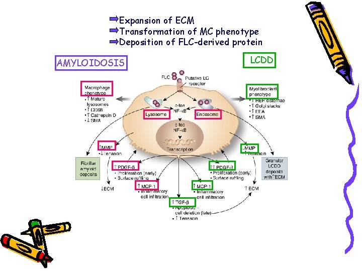 Expansion of ECM Transformation of MC phenotype Deposition of FLC-derived protein AMYLOIDOSIS LCDD 
