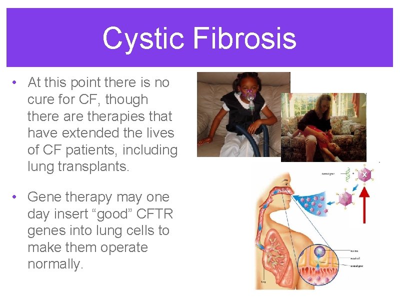 Cystic Fibrosis • At this point there is no cure for CF, though there