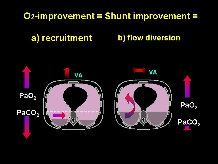O 2 -improvement = Shunt improvement = a) recruitment VA Pa. O 2 Pa.
