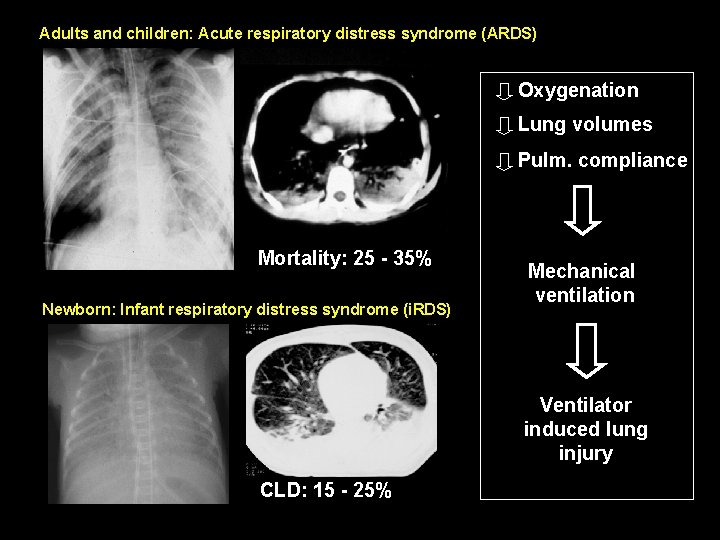 Adults and children: Acute respiratory distress syndrome (ARDS) Oxygenation Lung volumes Pulm. compliance Mortality:
