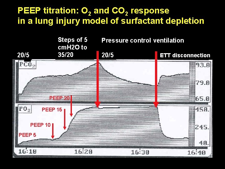 PEEP titration: O 2 and CO 2 response in a lung injury model of