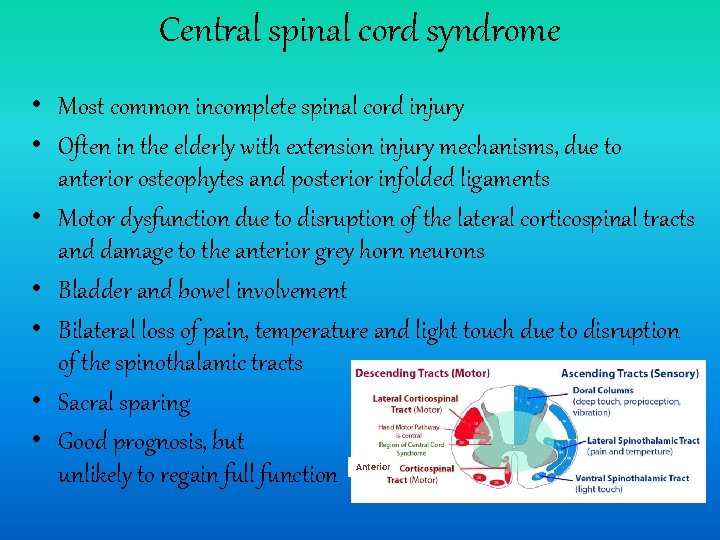 Central spinal cord syndrome • Most common incomplete spinal cord injury • Often in