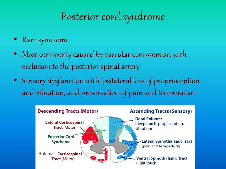 Posterior cord syndrome • Rare syndrome • Most commonly caused by vascular compromise, with