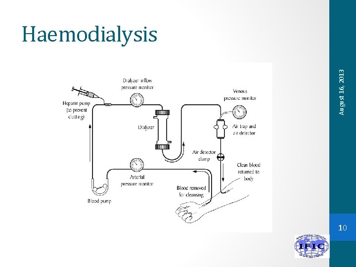 August 16, 2013 Haemodialysis 10 