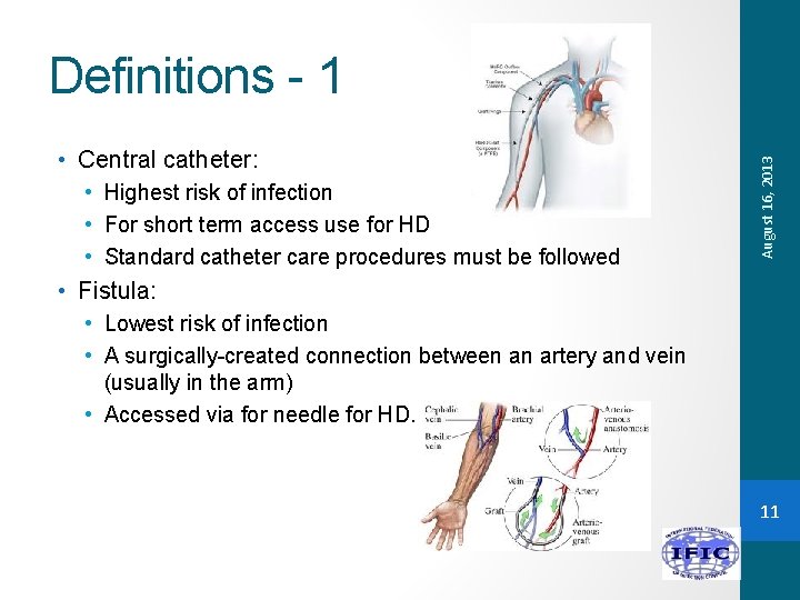  • Central catheter: • Highest risk of infection • For short term access