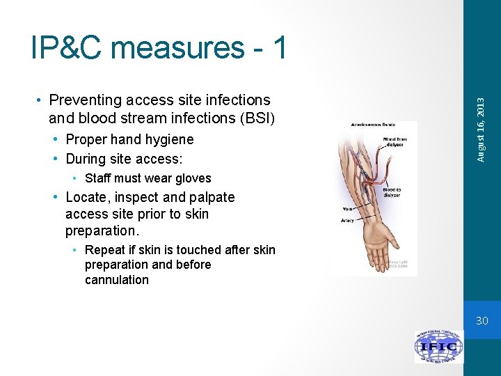  • Preventing access site infections and blood stream infections (BSI) • Proper hand