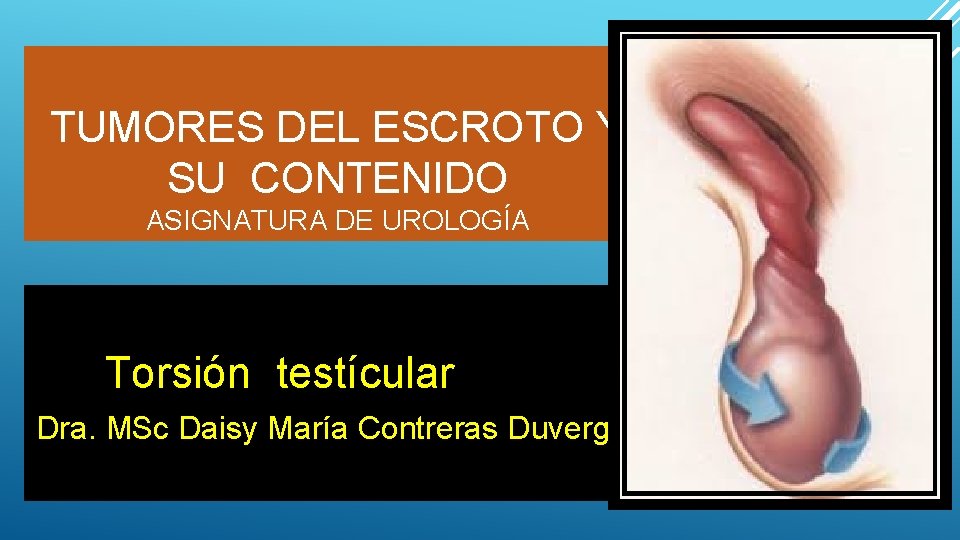 TUMORES DEL ESCROTO Y SU CONTENIDO ASIGNATURA DE UROLOGÍA Torsión testícular Dra. MSc Daisy
