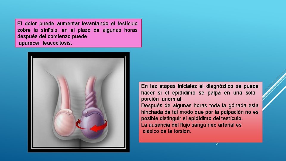 El dolor puede aumentar levantando el testículo sobre la sínfisis, en el plazo de