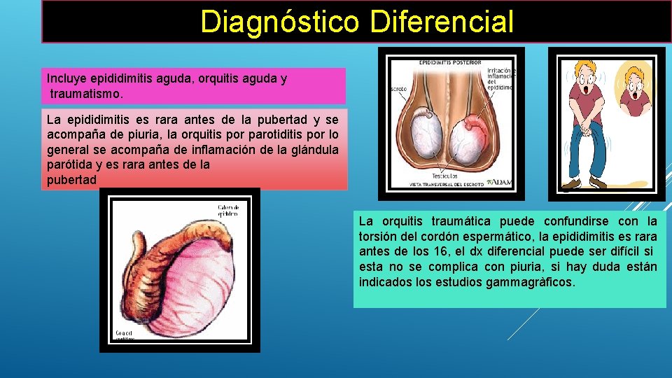 Diagnóstico Diferencial Incluye epididimitis aguda, orquitis aguda y traumatismo. La epididimitis es rara antes