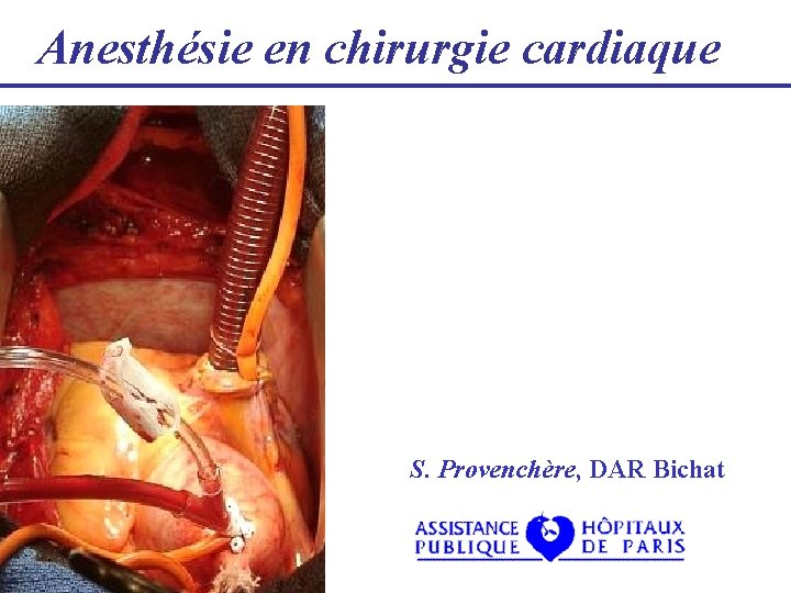 Anesthésie en chirurgie cardiaque S. Provenchère, DAR Bichat 