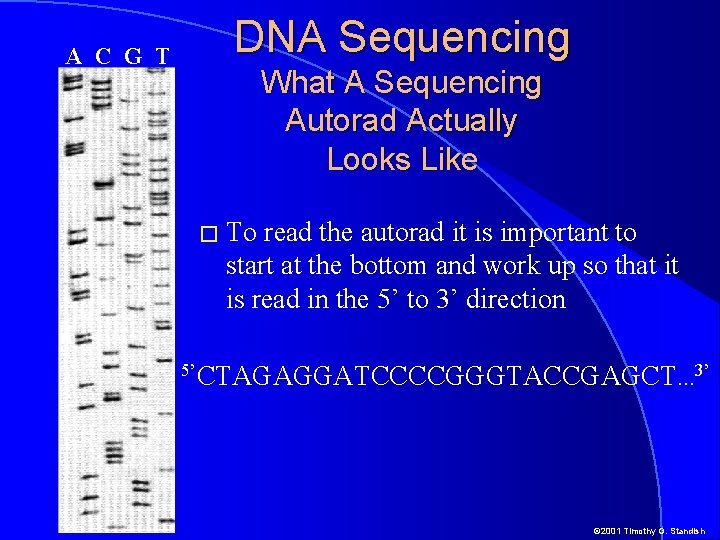 A C G T DNA Sequencing What A Sequencing Autorad Actually Looks Like �